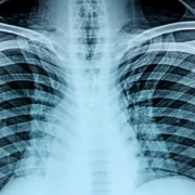 Świadomość Polaków o chorobach rzadkich rośnie, ale o Planie dla Chorób Rzadkich słyszało niewielu