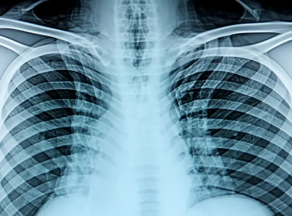 Świadomość Polaków o chorobach rzadkich rośnie, ale o Planie dla Chorób Rzadkich słyszało niewielu